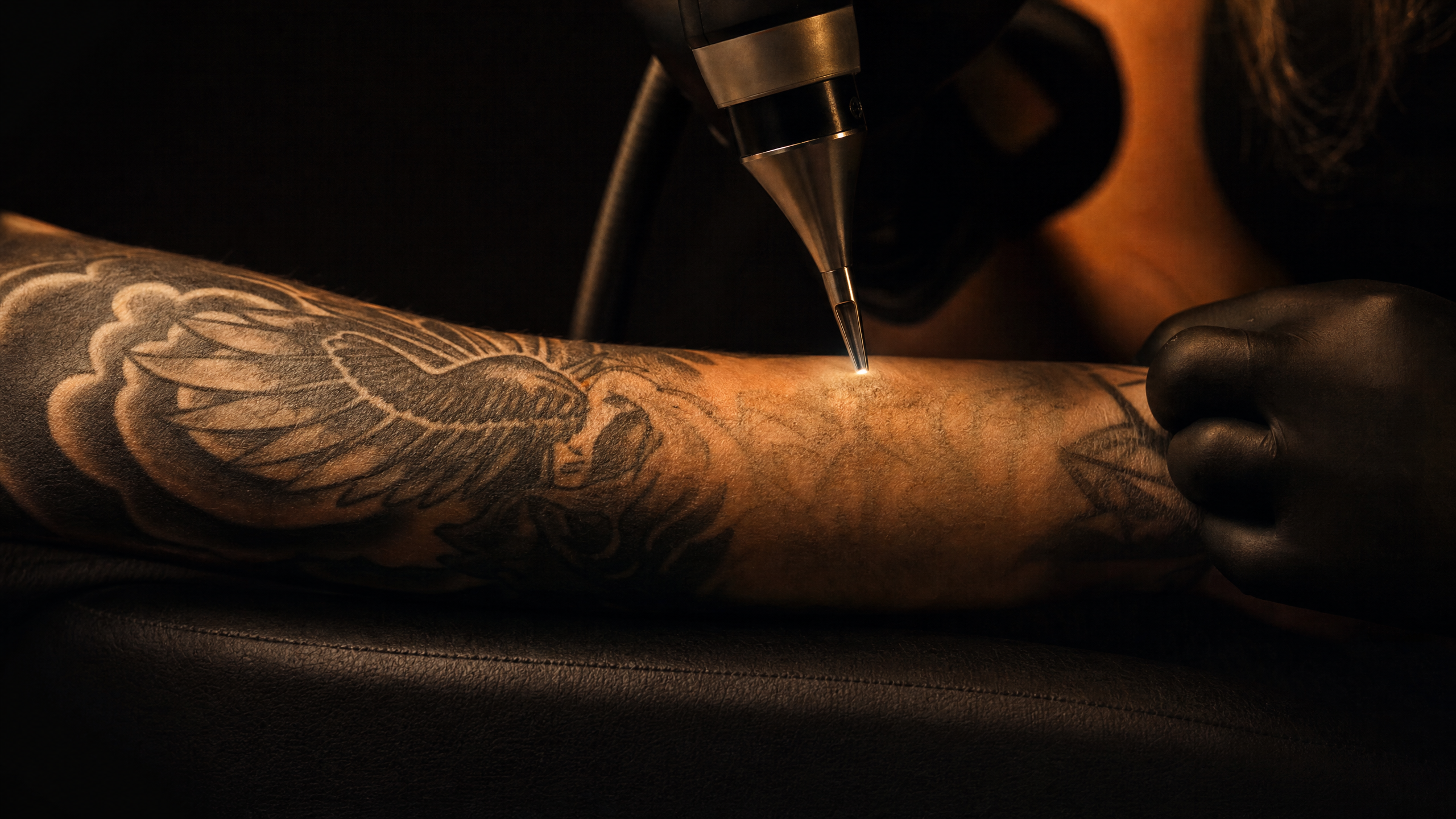 Pico laser tattoo removal